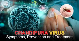 Chandipura Virus Symptoms